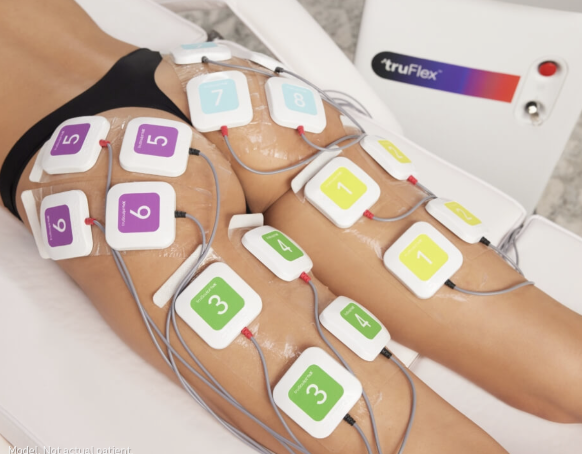 truFlex treatment targeting the glutes and thighs using muscle stimulation applicators during a non-invasive body sculpting session.